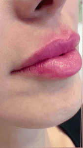 lips