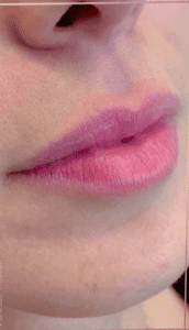 lips0