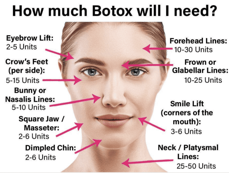image of how much botox do i need