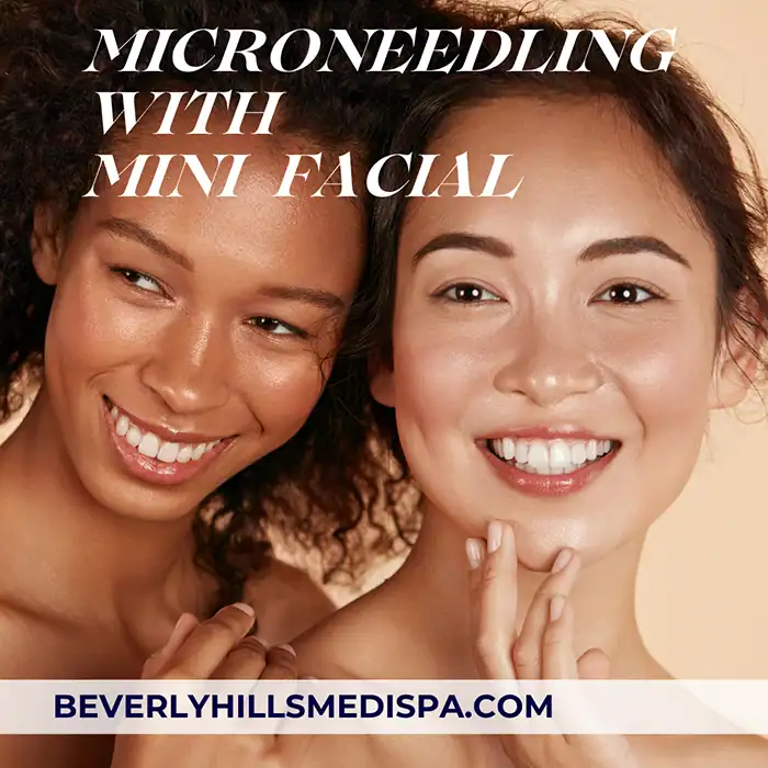 microneedling with mini facial price in Palm Beach, Florida microneedling with mini facial price in Palm Beach, Florida