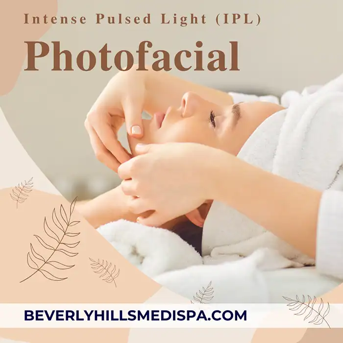 IPL Photofacial treatment price in Palm Beach, Florida IPL Photofacial treatment price in Palm Beach, Florida