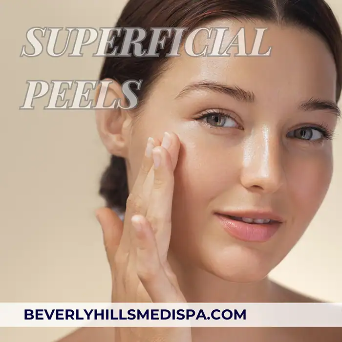 Superficial Chemical Peels Price in Palm Beach, Florida Superficial Chemical Peels Price in Palm Beach, Florida