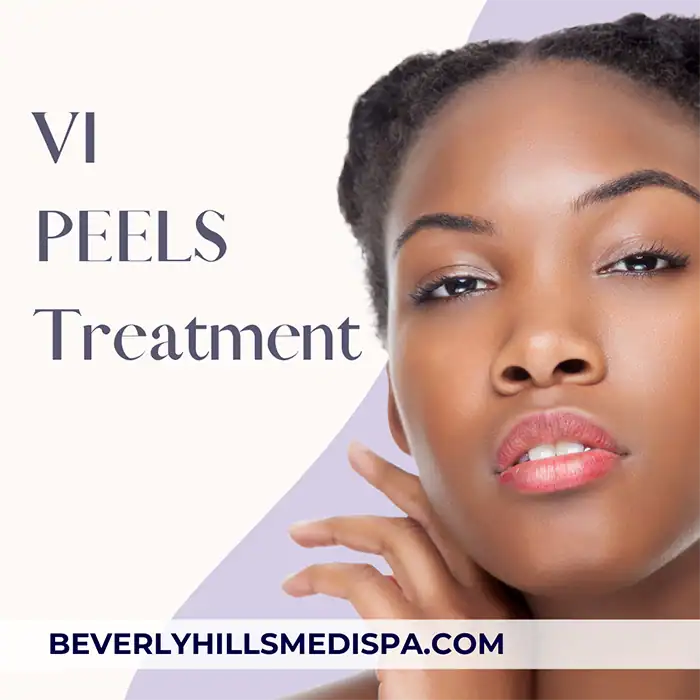 VI chemical peels treatment price in Palm Beach, Florida VI chemical peels treatment price in Palm Beach, Florida