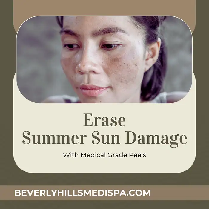 How medical-grade peels erase Summer sun damage?